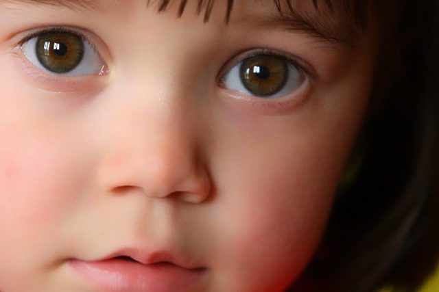 little girl vision therapy